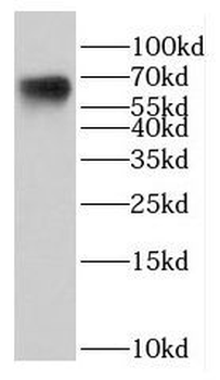 DTNB Rabbit Polyclonal Antibody