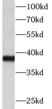 DTX3 Antibody