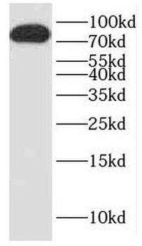 DTX3L Antibody