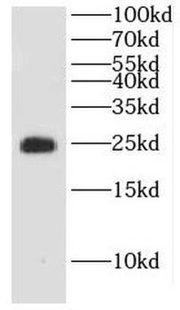 DTYMK Rabbit Polyclonal Antibody