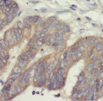 DTYMK Rabbit Polyclonal Antibody