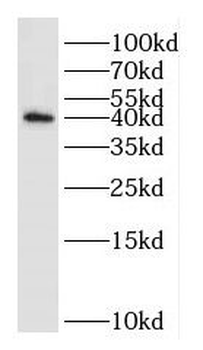 DUSP11 Rabbit Polyclonal Antibody