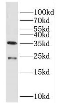 DUSP13B Rabbit Polyclonal Antibody
