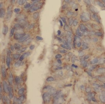 DUSP13B Rabbit Polyclonal Antibody