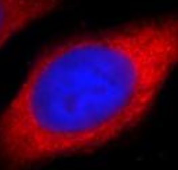 DVL2 Rabbit Polyclonal Antibody