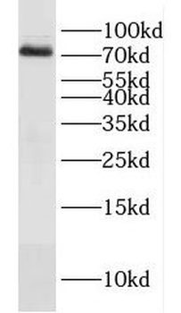 DVL3 Rabbit Polyclonal Antibody