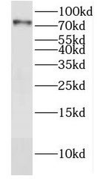 DYM Rabbit Polyclonal Antibody