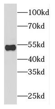 DCTN2 Rabbit Polyclonal Antibody