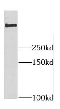 DYNC1H1 Rabbit Polyclonal Antibody