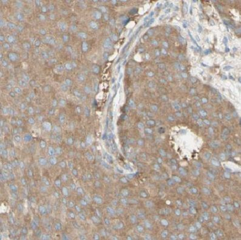DYNC1H1 Rabbit Polyclonal Antibody