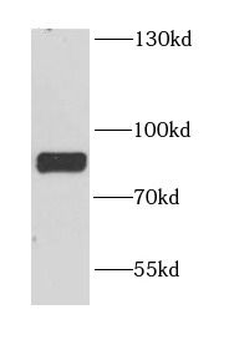 DYNC1I1 Rabbit Polyclonal Antibody