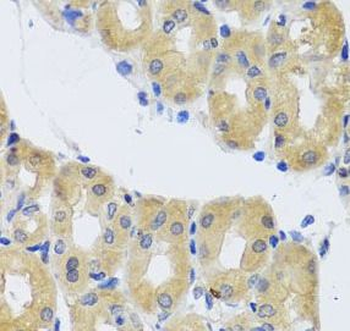 DYNC1I1 Rabbit Polyclonal Antibody