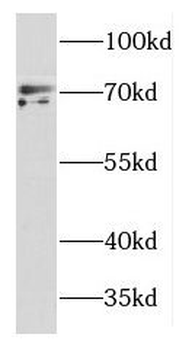 DYNC1I2 Rabbit Polyclonal Antibody