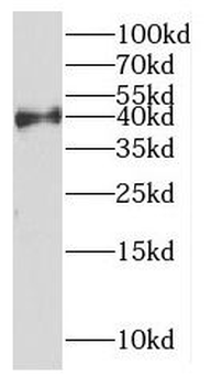DYNC2LI1 Rabbit Polyclonal Antibody