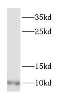DYNLL2 Rabbit Polyclonal Antibody
