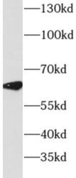 DYRK4 Rabbit Polyclonal Antibody