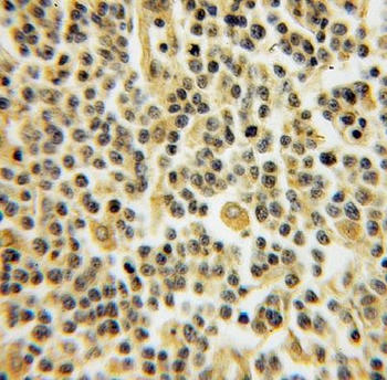 DYRK4 Rabbit Polyclonal Antibody