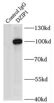 DZIP1 Rabbit Polyclonal Antibody