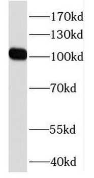 DZIP1 Rabbit Polyclonal Antibody