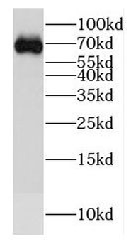 SLC1A6 Rabbit Polyclonal Antibody