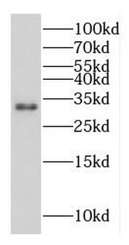 MAPRE3 Antibody