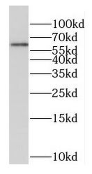 EBF1 Rabbit Polyclonal Antibody