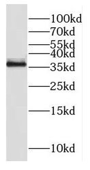 EBNA1BP2 Antibody