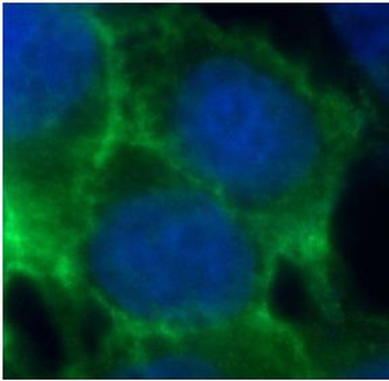 CDH1 Rabbit Polyclonal Antibody