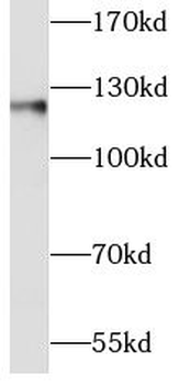CDH1 Rabbit Polyclonal Antibody