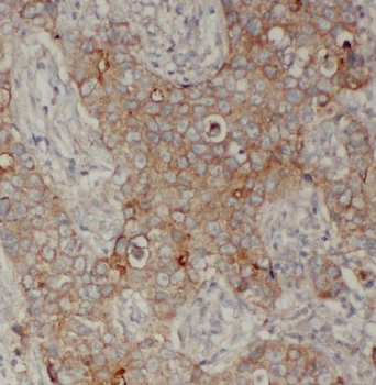 CDH1 Rabbit Polyclonal Antibody