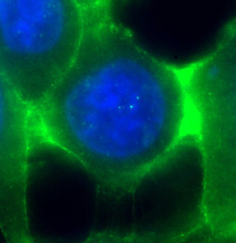 CDH1 Rabbit Polyclonal Antibody