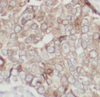 CDH1 Rabbit Polyclonal Antibody