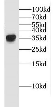 ECH1 Rabbit Polyclonal Antibody