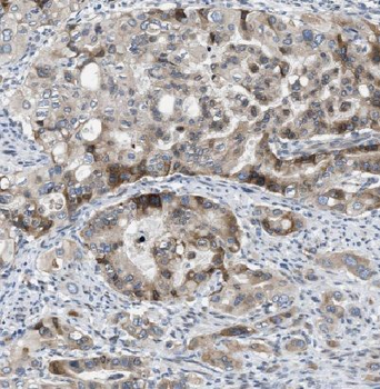 ECH1 Rabbit Polyclonal Antibody