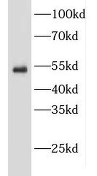 EDNRB Rabbit Polyclonal Antibody