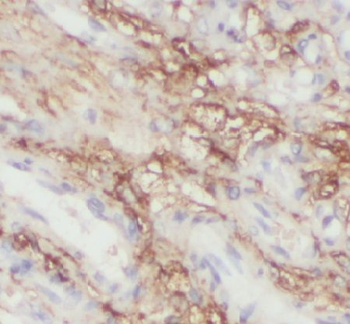 EDNRB Rabbit Polyclonal Antibody