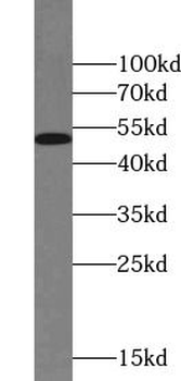 EEF1A2 Rabbit Polyclonal Antibody
