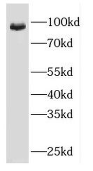 EEF2 Rabbit Polyclonal Antibody