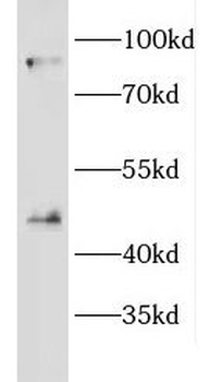 CRACR2A Rabbit Polyclonal Antibody