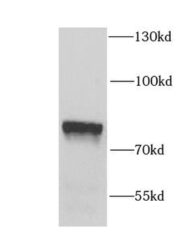 EFHC1 Rabbit Polyclonal Antibody