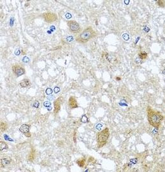 EFHC1 Rabbit Polyclonal Antibody