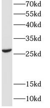 EFHD2 Rabbit Polyclonal Antibody