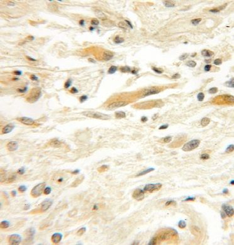 EFHD2 Rabbit Polyclonal Antibody