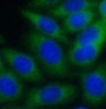 EHBP1 Antibody