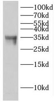 EHF Rabbit Polyclonal Antibody