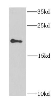 EIF1AY Rabbit Polyclonal Antibody