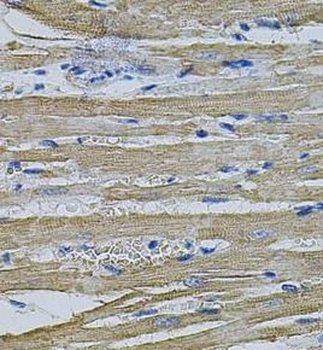 EIF1AY Rabbit Polyclonal Antibody