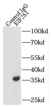 EIF2S1 Rabbit Polyclonal Antibody