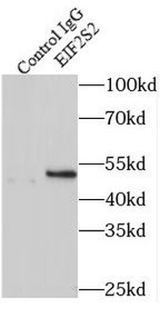 EIF2S2 Rabbit Polyclonal Antibody