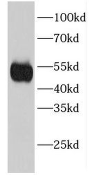EIF2S2 Rabbit Polyclonal Antibody